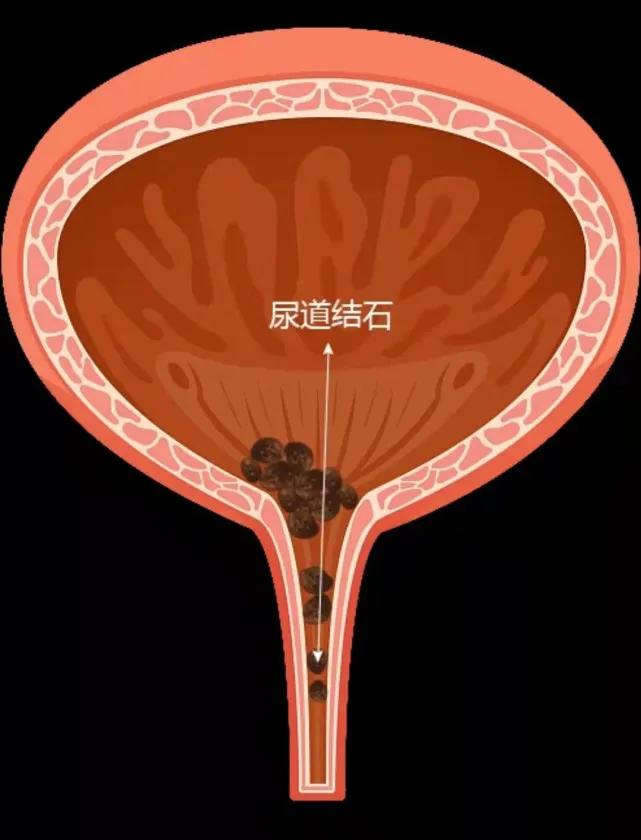 购买家居电器_跑步机使用场景_买什么牌子跑步机好