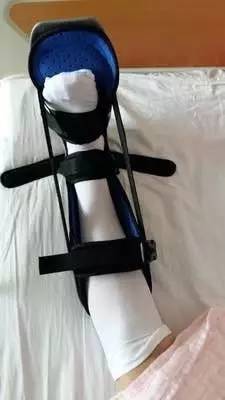 髋关节训练椅_髋关节置换术适应症 _ 人工关节置换术前准备