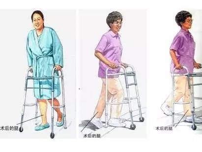 髋关节训练椅_ 人工关节置换术前准备 _髋关节置换术适应症