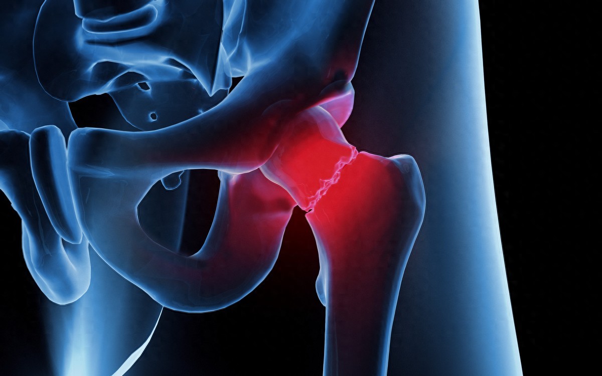 开yunapp体育官网入口下载手机版 科普 | 做好家庭护理让生活 “髋” 然一新：人工髋关节置换术后的家庭护理