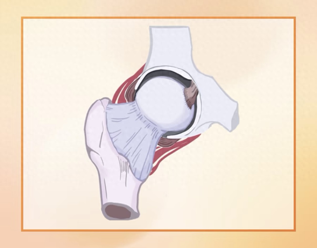 yy漫画画免费读漫画下拉式 别等疼到走不了路才重视！髋关节养护，这几点人人都该知道