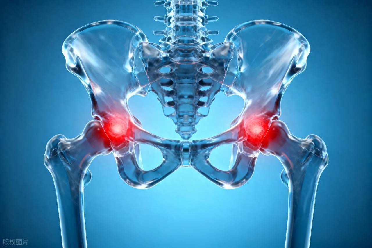 韩漫漫画网站免费观看下拉式 别再轻视髋关节卡顿！研究显示：活动异常或提升退化风险